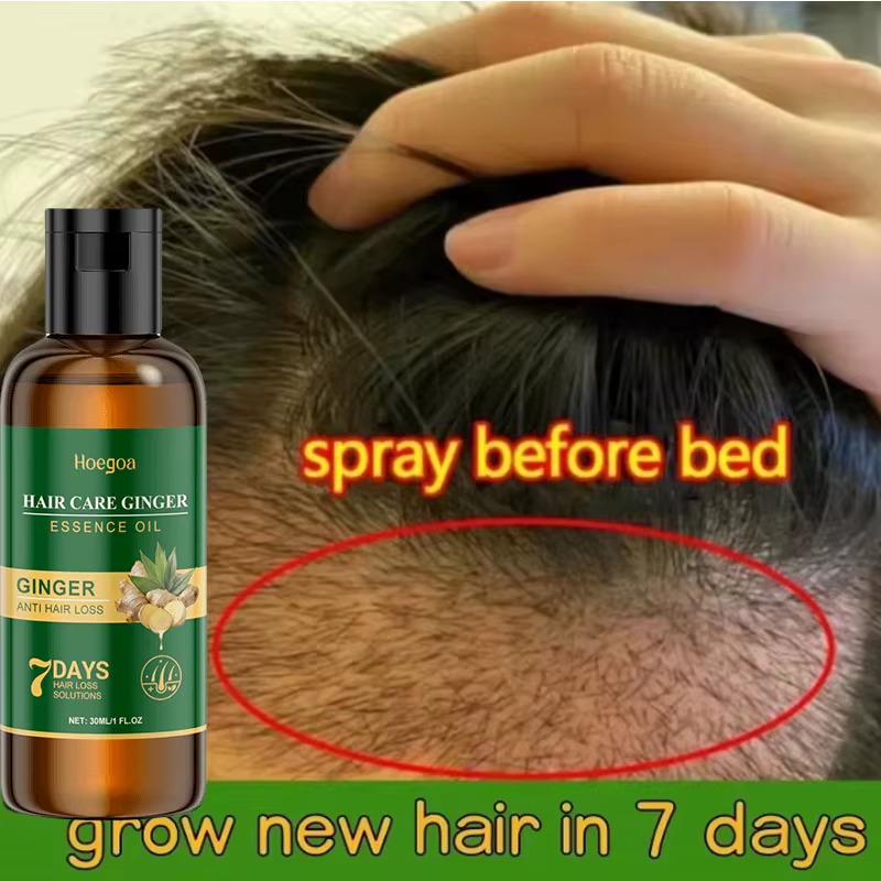 Sérum de croissance des cheveux au gingembre, huile essentielle de repousse rapide de 7 jours, Anti-