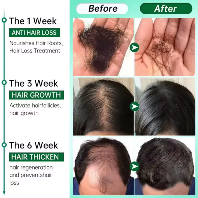 Sérum de croissance des cheveux au gingembre, huile essentielle de repousse rapide de 7 jours, Anti-chute des cheveux, prévient les cheveux secs, crépus et endommagés, produits de réparation