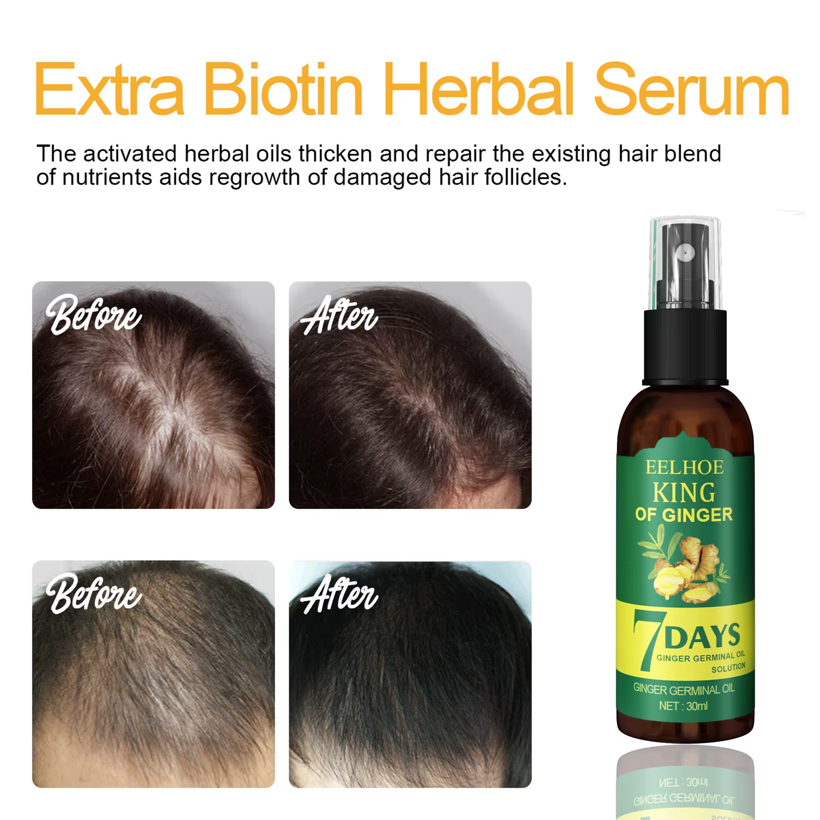 Sérum Booster capillaire à l'huile de gingembre, Spray nourrissant le cuir chevelu, contrôle des follicules pileux, huile rafraîchissante, renforce les racines des cheveux, Solution nutritive