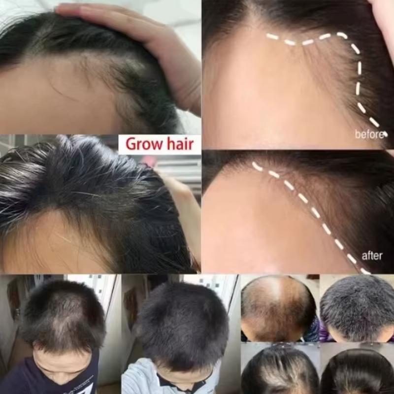 Sérum de croissance des cheveux au gingembre, huile essentielle de repousse rapide de 7 jours, Anti-chute des cheveux, prévient les cheveux secs, crépus et endommagés, produits de réparation